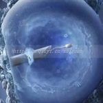 曲靖试管有成功的吗-曲靖三代试管龙凤胎大概多少钱