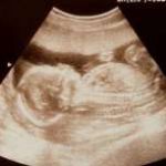 私立医院三代试管龙凤胎(高龄可以吗?) 私立医院三代试管龙凤胎(高龄可以吗?)