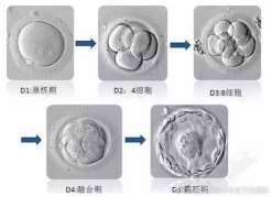 高龄做试管婴儿先要从这些方面入手