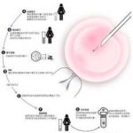 第三代试管婴儿生个儿子要多少钱费用十万够吗? 第三代试管婴儿生个儿子要多少钱费用十万够吗?