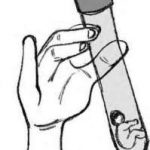 驻马店试管3代要多少钱「郑州三代试管费用」