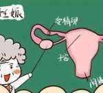 卵巢只有一两个窦卵泡是正常 正常卵巢有几个窦卵泡 卵巢只有一两个窦卵泡是正常 正常卵巢有几个窦卵泡