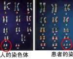 楚为医生告诉你高龄女性提高试管的小妙招 楚为医生告诉你高龄女性提高试管的小妙招