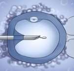 普洱三代试管婴儿选择性别多少钱