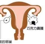 染色体平衡易位三代试管成功概率高[中国试管婴儿]
