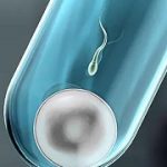 深圳如何帮助怀孕第三代试管婴儿? 深圳如何帮助怀孕第三代试管婴儿?