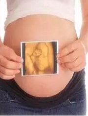 济南女性染色体异常可以做三代试管吗,共同见证奇迹！