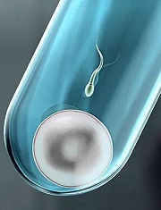 韶关高龄女性基础卵泡少做几代试管？