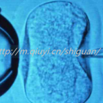 丽水三代试管助孕捐卵生孩子公司如何选择