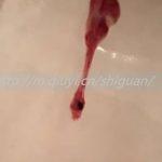 南宁三代试管助孕供卵生孩子医院大全