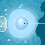 试管供卵官网 高龄女性备孕需要注意什么呢？