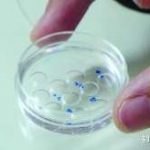 西宁三代试管能排除鱼鳞病吗(西宁试管婴儿成功率) 西宁三代试管能排除鱼鳞病吗(西宁试管婴儿成功率)