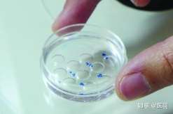 西宁三代试管能排除鱼鳞病吗(西宁试管婴儿成功率)