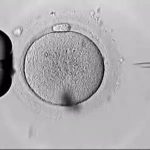 供精试管婴儿费用[阿克苏洗精试管费用多少钱]