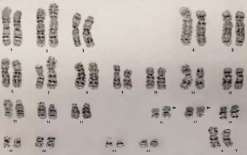 10个人做试管成功率有多少？