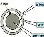上海第三代试管男孩排名前五的医院有哪些？有哪些流程？