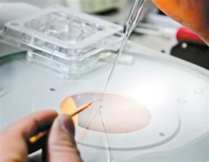 安徽三代试管包生男孩费用多少