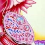 深圳卵巢储备功能下降三代试管能成功吗_正规供卵试管生子机构