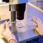 高危型hpv51阳性 hpv阳性影不影响试管成功率