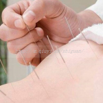 山东三代试管_德州第三代试管可以做双胞胎吗