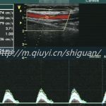 东莞三代试管婴儿私人生孩子医院排名哪家最好