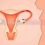 陕西三代试管婴儿供卵_榆林第三代试管可以选性别吗