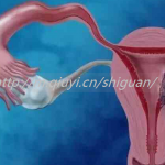 长治三代试管能做双胞胎吗？长治三代试管能做双胞胎吗医生？