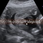 为生儿子可以通过三代试管助孕供卵怀孩子吗