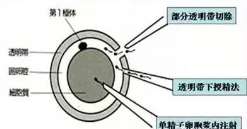 唐山第三代试管是什么意思？做第三代试管婴儿费用是多少