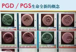 南京第三代试管可以做龙凤胎吗-正规试管供卵机构