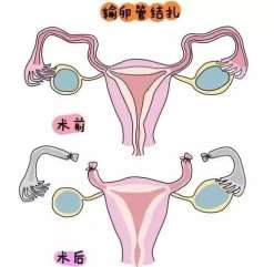 如何选择正确国内三代试管机构