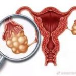 芜湖三代试管胚胎筛查哪些？三代试管免费筛查囊胚