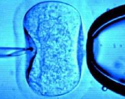 【最好最快】合肥高龄绝经供卵试管婴儿