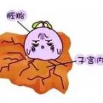 俄罗斯卵子少能做三代试管吗 俄罗斯卵子少能做三代试管吗