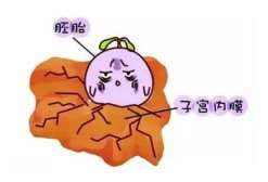 俄罗斯卵子少能做三代试管吗