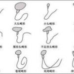 深圳三代试管包生男孩费用-正规供卵试管机构