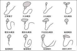 深圳三代试管包生男孩费用-正规供卵试管机构