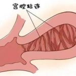 广西高龄供卵试管也难成功