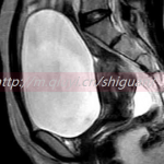 不结婚可以通过三代试管借卵生子吗