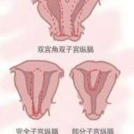长春单角子宫三代试管能成功吗_试管生殖助孕机构 长春单角子宫三代试管能成功吗_试管生殖助孕机构