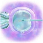 拉萨先天性先天性无子宫三代试管婴儿费用？