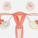 荆门试管成功率最高的医院「荆门一医试管婴儿」