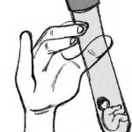 江苏三代试管包生男孩价格是多少