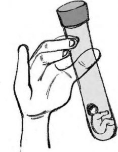 江苏三代试管包生男孩价格是多少