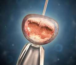 珠海三代试管湖南