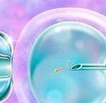 2023重庆三代试管婴儿生龙凤胎费用分析，教你3招降低手术费用