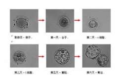 徐州三代试管包生男孩