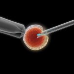 为什么大龄供卵试管成功率高:鲜胚成功率90% 为什么大龄供卵试管成功率高:鲜胚成功率90%