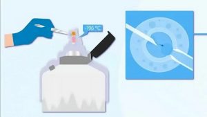 北京试管助孕-北京三代试管医院