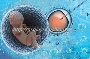 [镇江四院试管成功率]镇江三代试管太贵了